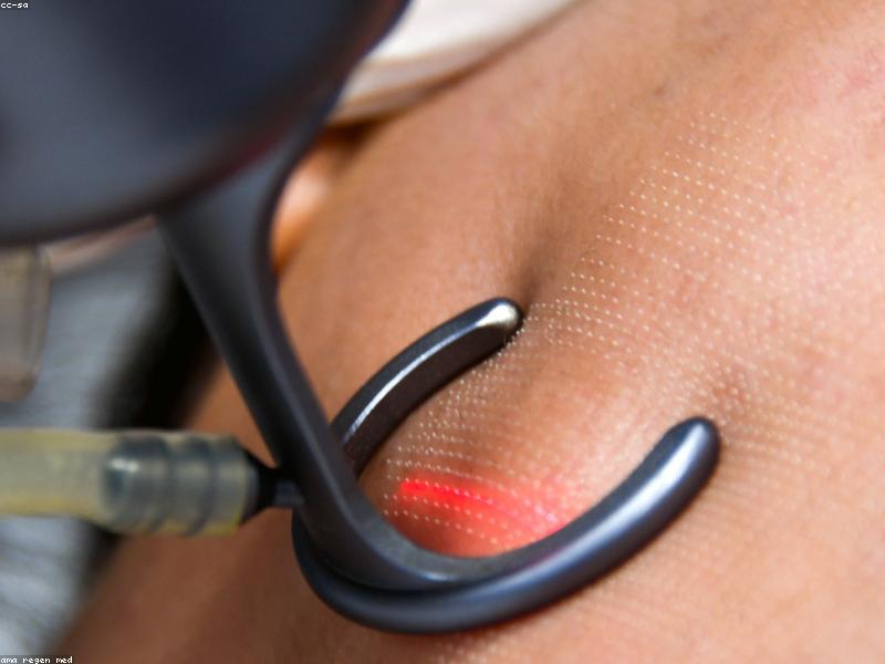 Tiêm filler & botox